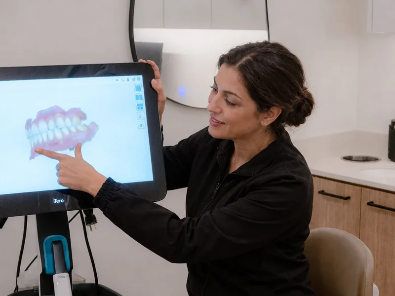 A 3D scan of teeth on the iTero screen.